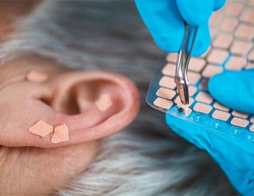 ear-acupuncture-point-therapy-XH4D6ML